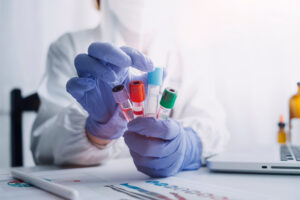 doctor hand taking a blood sample tube from a rack with machines